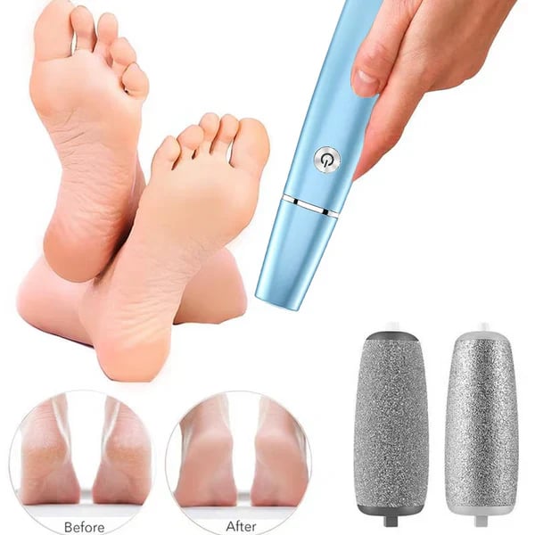 🎅LAST DAY SALE 50% OFF!!⚡50K+ SOLD!❤️Electric Feet Callus Remover-11