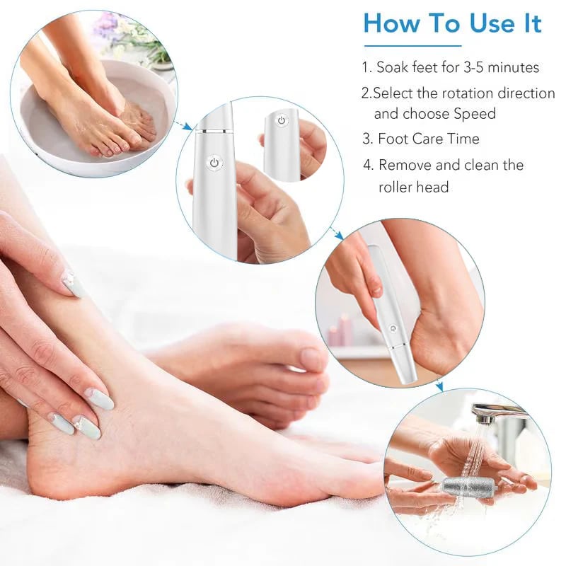 🎅LAST DAY SALE 50% OFF!!⚡50K+ SOLD!❤️Electric Feet Callus Remover-9