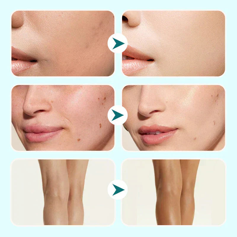 🔥Last Day-Buy 1 Get 1 Free!🎁All-in-one Moisturizer, Concealer & Coverage 💧✨ Lightweight & waterproof✨-8