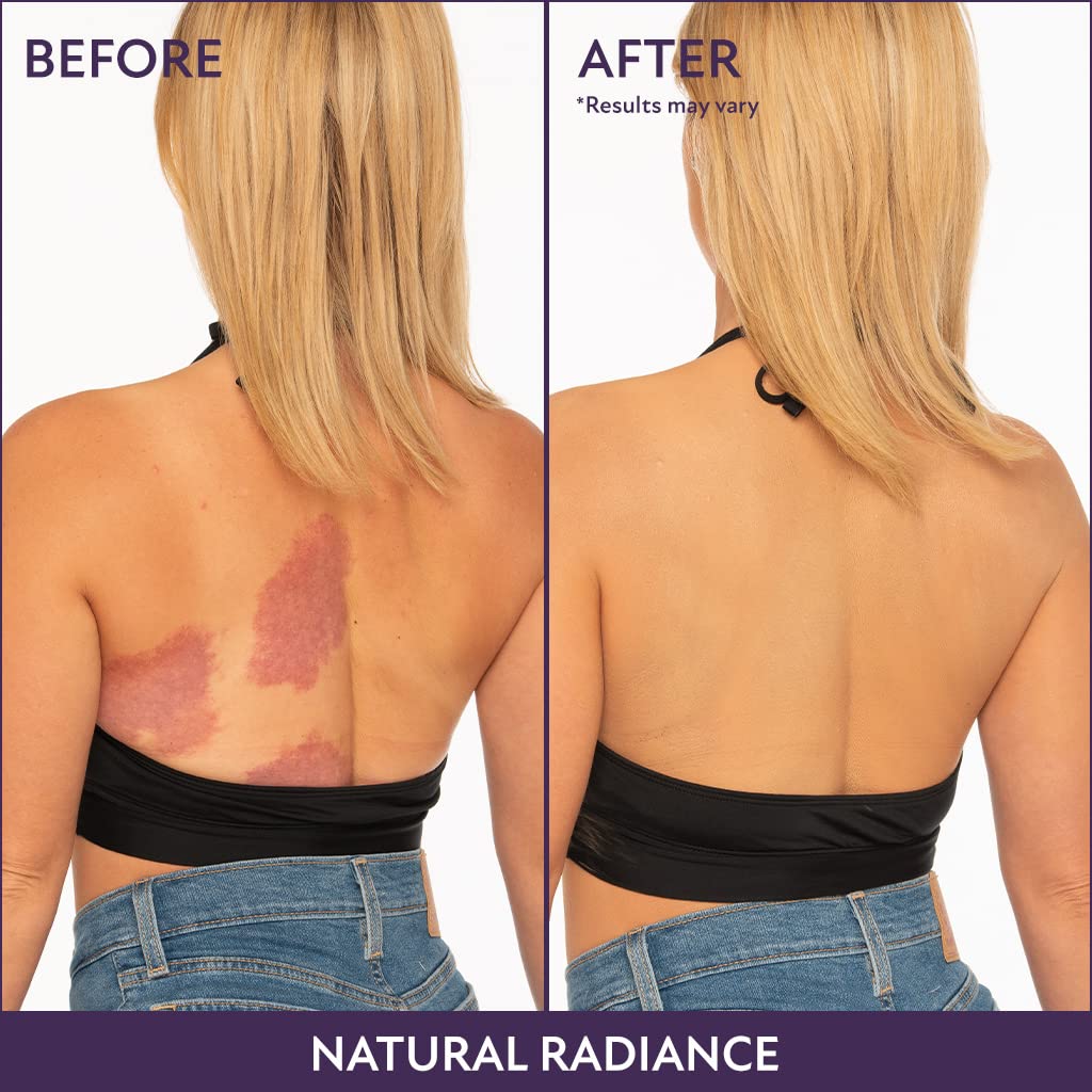 🔥Last Day-Buy 1 Get 1 Free!🎁All-in-one Moisturizer, Concealer & Coverage 💧✨ Lightweight & waterproof✨-13