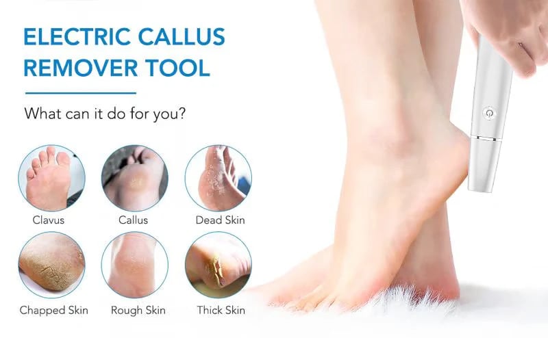 🎅LAST DAY SALE 50% OFF!!⚡50K+ SOLD!❤️Electric Feet Callus Remover-10